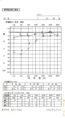 ストレスが原因で低音の左聴力が低下した左耳突発性難聴｜治療前のオージオグラム