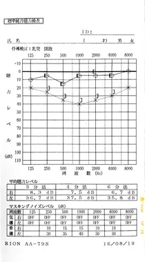 鍼治療で聴力が回復した血液循環の悪化が原因の左耳突発性難聴｜治療後のオージオグラム