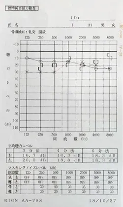 鍼治療でよくなった突発性難聴