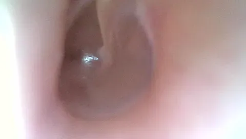 健康な鼓膜