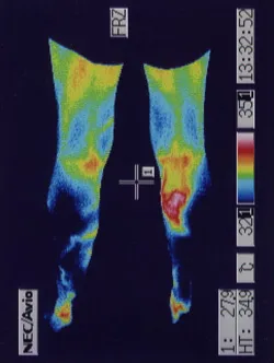 ふくらはぎの温度が低いサーモグラフィ画像