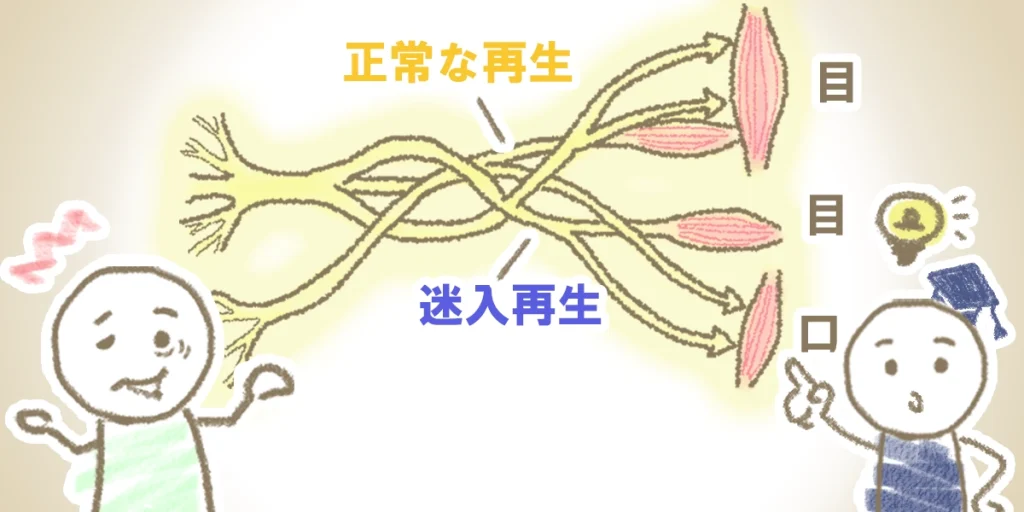 迷入再生|回復の過程で神経が誤った筋肉に繋がってしまう様子を図解