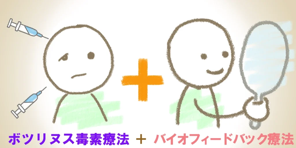 ボトックスとリハビリを組み合わせた相乗効果が改善に効果的である図