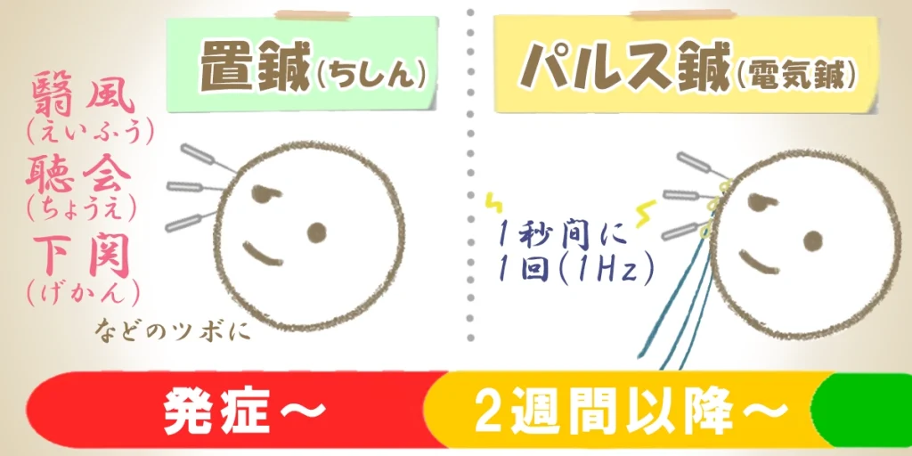 発症~2週間の鍼治療と2週間以降の鍼治療の違いを表した図