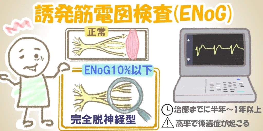 誘発筋電図検査(ENoG)が10%以下は「完全脱神経型」を表します。