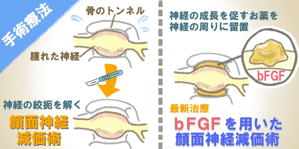 手術療法の例を図解